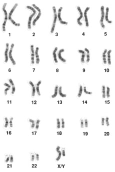 каріограма-хромосома