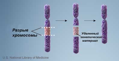 делеция, хромосома, разрыв, ген, генетика, мутация