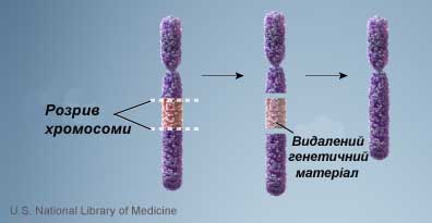 делеція, мутація, хромосома, генетика, ген