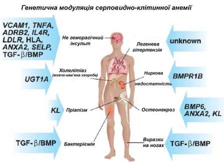 генетика, серповидно клітинна анемія, еритроцити, ниркова недостатність